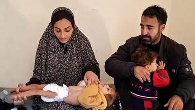 سوء‌تغذیه با کودکان غزه چه می‌کند؟