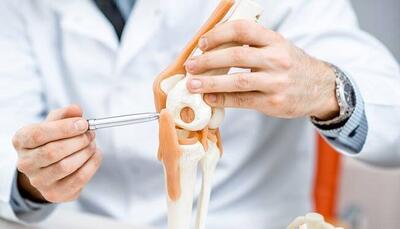 این افراد بیشتر در معرض خطر شکستگی استخوان هستند