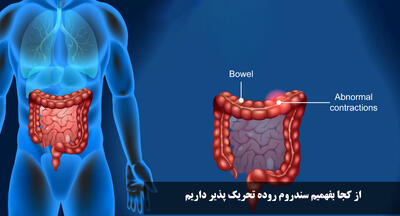 از کجا بفهمیم سندروم روده تحریک پذیر داریم؟ علائم آن در زنان و مردان چیست؟
