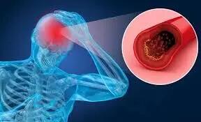 علائم غلظت خون چیست؟ |ارتباط بین غلظت خون و سابقه بیماری‌ها