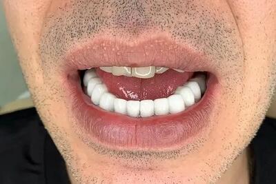 راز لبخندهای درخشان و طبیعی برخی افراد چیست؟