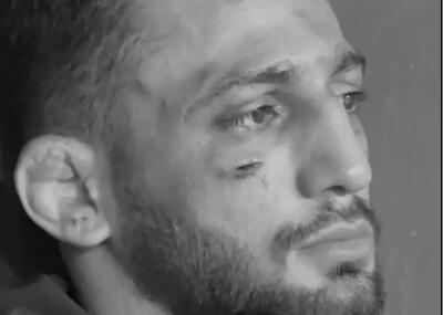 صورت زخمی ایران چهره اسنایدر را فراموش نمی‌کند!