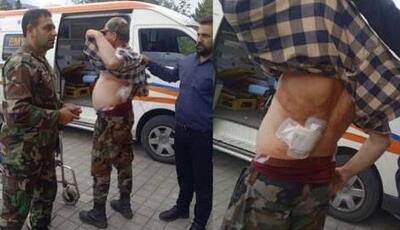 آخرین وضعیت حال جنگلبان گیلانی که توسط فرد محلی با سلاح سرد مجروح شد