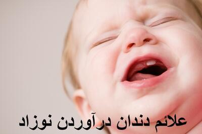 علائم دندان درآوردن نوزاد + دارو و راهکارهای کاهش درد دندان درآوردن نوزاد