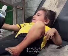 تصاویر غم‌انگیز از مجروح‌شدن کودک فلسطینی بر اثر حملات رژیم صهیونیستی