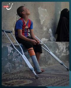 لوله پلاستیکی جای پای قطع شده کودک فلسطینی را گرفت