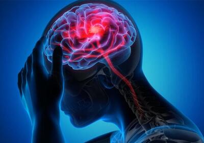 هشدار متخصصان مغز و اعصاب درباره ابتلا به مه مغزی - اکونیوز