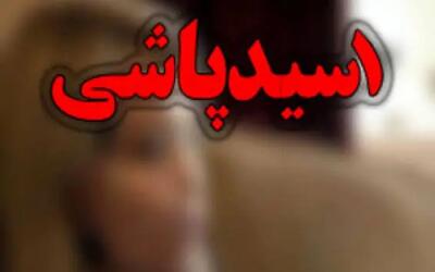 صدور حکم قضایی سارق اسیدپاش با تحمل ۳۰ سال حبس