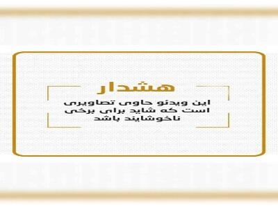 خارج کردن یک خرچنگ کوچک و زنده از گوش یک کودک (16+)