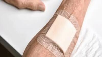 تولید ژل درمانی گیاهی برای ترمیم زخم دیابتی و زخم بستر (فیلم)