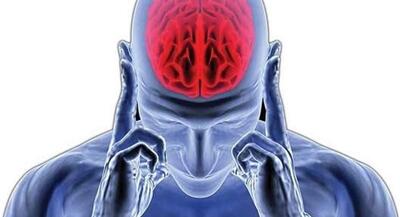 علائم و مراحل آغاز آلزایمر چیست؟ | جهان نیوز