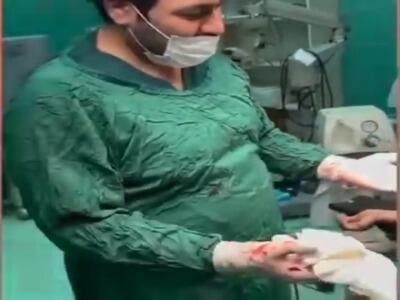 خارج شدن یک کرم‌ عجیب و غریب از معده بیمار