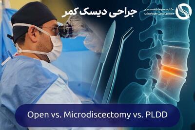 مقایسه عمل های دیسک کمر (جراحی باز VS میکروسکوپی VS لیزر دیسک کمر)