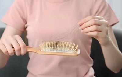علت ریزش مو در نوجوانان دختر و پسر + روش‌های موثر درمان و پیشگیری
