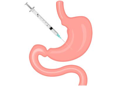 هشدار متخصصان درباره بوتاکس معده؛ کاهش وزن موقتی یا عوارض دائمی؟