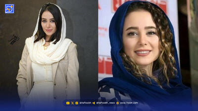 کاشت مژه الناز حبیبی