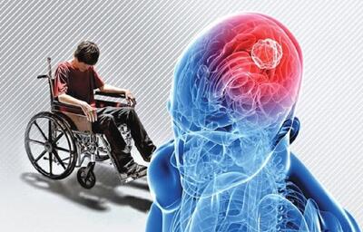 علائم‌ام اس را بشناسید/ کدام نشانه‌ها خطرناک است؟ | اقتصاد24