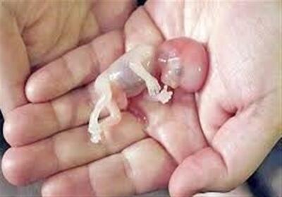نفس تازه در زندگی 467 نوزاد؛ روایت مرکز تخصصی   نفس   در سمنان - تسنیم