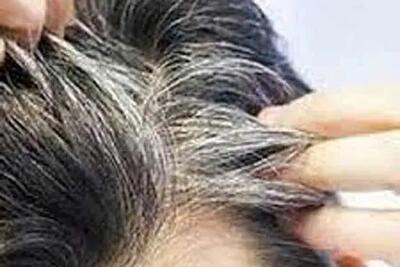 دلیل خشکی مو با وجود چربی کف سر چیست؟