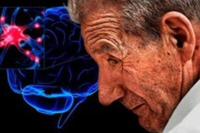 آیا سلول‌های بنیادی می‌تواند آلزایمر و پارکینسون را درمان کند؟