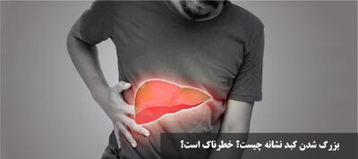 بزرگ شدن کبد نشانه چیست؟ خطرناک است؟ آیا درمان دارد؟