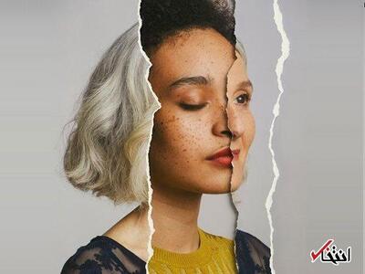 پرونده‌ی غم‌انگیز جوان‌ترین فرد مبتلا به آلزایمر
