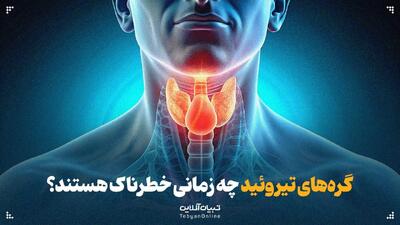 گره‌های تیروئید چه زمانی خطرناک هستند؟