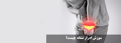 سوزش ادرار نشانه چیست؟ علت سوزش بعد از تخلیه ادرار در زنان و مردان چیست؟