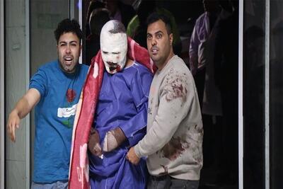 اهوازبرای خدمت رسانی به درمان سوختگی جنوب غرب کشور آماده است