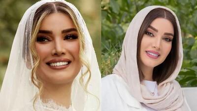 قاب روز | متین ستوده در خانه پدری و قبل از عمل های زیبایی