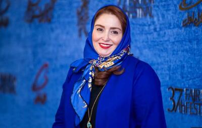 ژاله صامتی با عمل زیبایی از خودش یک مدل ساخت+ عکس