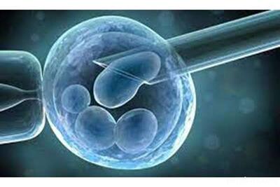 بررسی تمام هزینه‌های IVF در ۱۴۰۴ (بیمه ، تعیین جنسیت و مبالغ جدید)