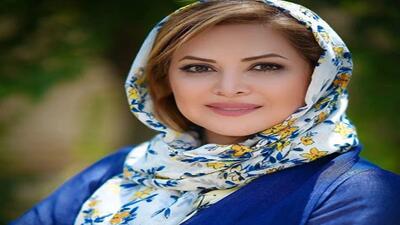 تصویر روز | کمند امیرسلیمانی بعد از جراحی های زیبایی | گلی شی