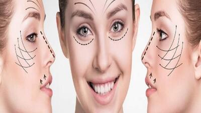میگنا - تقلیدی که زنان ایرانی را شبیه هم کرده است