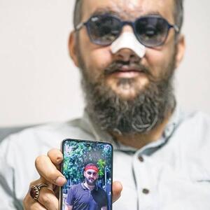 جانباز حمله تروریستی پیجرها: خدا چشمم را روشن کرد