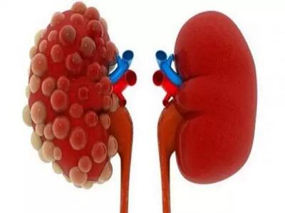 خواص بی‌نظیر این میوه برای کبد و کلیه