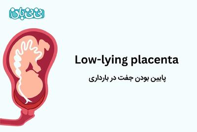 پایین بودن جفت در بارداری ـ ۴ علامت آن و عوارض + راهکارهایی برای بالا رفتن جفت