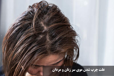 علت چرب شدن موی سر زنان و مردان + درمان قطعی چربی پوست سر