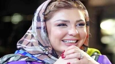 تصویر روز | نگاهی به چهره تغییر یافته نیوشا ضیغمی | گلی شی