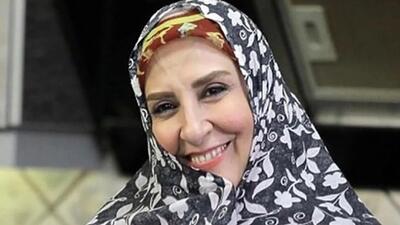 تصویر روز | تغییر چهره مرجانه گلچین غوغا بپا کرد | گلی شی