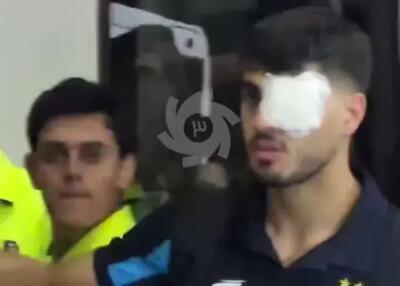 سحرخیزان: چشمم نمی‌بیند!