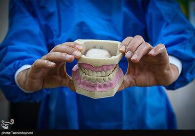 دانش‌آموزان دبستانی به طور میانگین 5 دندان پوسیده دارند/اجرای پویش سلامت دهان از هفته آینده - تسنیم