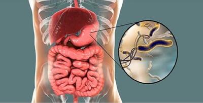 میکروب معده دارید ؟ این میوه ها را بخورید