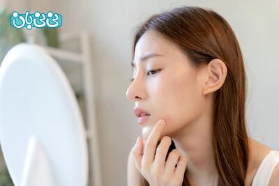 ۱۰ علائم تشخیص بارداری از روی چهره _ جدول علائم بارداری دختر و پسر از روی چهره
