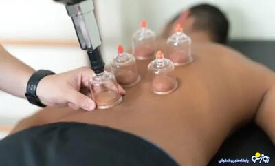بهترین روز‌ها برای حجامت در پاییز