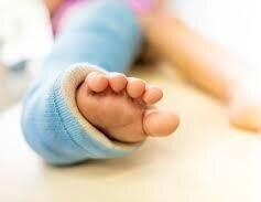 کمک فوری برای درمان پاهای کودک 2 ماهه