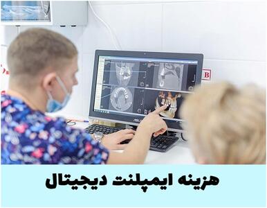 هزینه ایمپلنت دیجیتال ( جدول قیمت ۱۴۰۴ + مزایا و طول عمر)