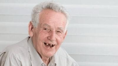 معاون وزیر بهداشت: بیش از نیمی از افراد بالای ۶۵ سال در ایران، هیچ دندانی ندارند