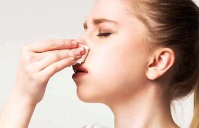 چطور خون‌دماغ را در چند دقیقه متوقف کنیم؟