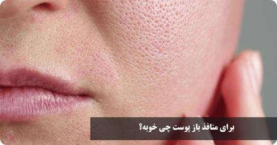برای منافذ باز پوست چی خوبه؟ درمان قطعی منافذ باز پوست صورت خانگی